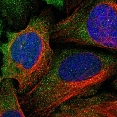 Immunocytochemistry/Immunofluorescence: LRRC37B Antibody [NBP1-91094] - Immunofluorescent staining of human cell line U-2 OS shows localization to cytosol.