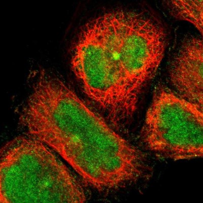 Immunocytochemistry/Immunofluorescence: CCDC176 Antibody [NBP1-91199] - Immunofluorescent staining of human cell line A-431 shows localization to nucleus & microtubule organizing center.