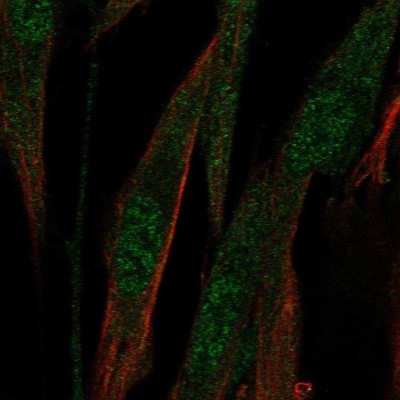 Immunocytochemistry/Immunofluorescence: ABCA8 Antibody [NBP1-91641] - Staining of human cell line ASC TERT1 shows localization to nucleoplasm & cytosol.