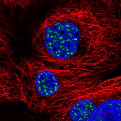 Immunocytochemistry/Immunofluorescence: SON Antibody [NBP2-55411] - Staining of human cell line A-431 shows localization to nuclear speckles.