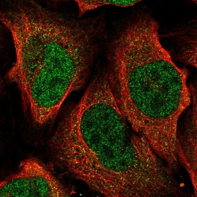 Immunocytochemistry/Immunofluorescence: ATP6V1A Antibody [NBP2-55148] - Staining of human cell line U-2 OS shows localization to nucleoplasm & cytosol.