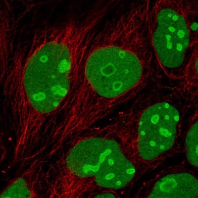 Immunocytochemistry/Immunofluorescence: EMG1 Antibody [NBP2-55324] - Staining of human cell line CACO-2 shows localization to nucleus & nucleoli.