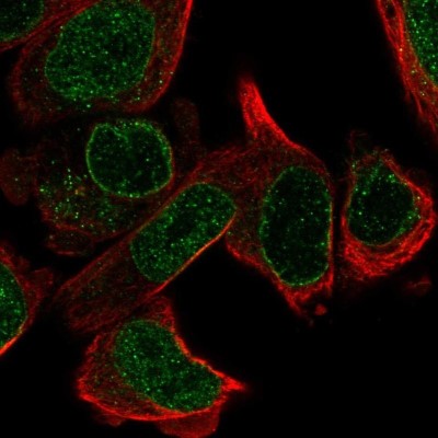 Immunocytochemistry/Immunofluorescence: PPIL5 Antibody [NBP2-57485] - Staining of human cell line PC-3 shows localization to nucleoplasm, nuclear membrane & vesicles.
