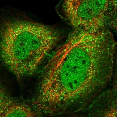 Immunocytochemistry/Immunofluorescence: GEM Interacting Protein Antibody [NBP2-30827] - Staining of human cell line A-431 shows localization to nucleoplasm, plasma membrane & cytosol.