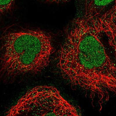 Immunocytochemistry/Immunofluorescence: PLEKHG1 Antibody [NBP1-90845] - Staining of human cell line A-431 shows positivity in nucleus.