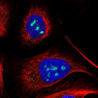 Immunocytochemistry/Immunofluorescence: KNDC1 Antibody [NBP1-90772] - Staining of human cell line U-2 OS shows positivity in nucleoli.