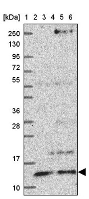 Western Blot: V-type proton ATPase subunit F Antibody [NBP2-38942] - Lane 1: Marker  [kDa] 250, 130, 95, 72, 55, 36, 28, 17, 10.  Lane 2: Human cell line RT-4.  Lane 3: Human cell line U-251MG.  Lane 4: Human Plasma.  Lane 5: Human liver tissue.  Lane 6: Human tonsil tissue