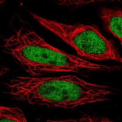 Immunocytochemistry/Immunofluorescence: NUP188 Antibody [NBP2-38936] - Immunofluorescent staining of human cell line SiHa shows localization to nucleoplasm.