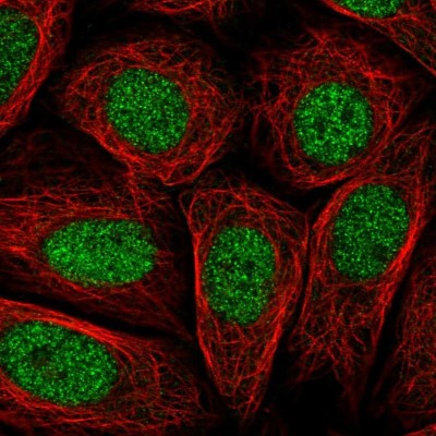 Immunocytochemistry/Immunofluorescence: PRR14L Antibody [NBP2-38968] - Immunofluorescent staining of human cell line SiHa shows localization to nucleoplasm.