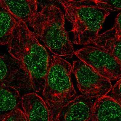 Immunocytochemistry/Immunofluorescence: ZNF383 Antibody [NBP2-38034] - Immunofluorescent staining of human cell line RT4 shows localization to nucleus & nuclear membrane.