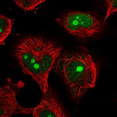 Immunocytochemistry/Immunofluorescence: NOC4L Antibody [NBP2-55061] - Staining of human cell line U-251 MG shows localization to nucleus & nucleoli.