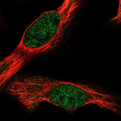 Immunocytochemistry/Immunofluorescence: HNRPGT Antibody [NBP1-92000] Staining of human cell line U-2 OS shows positivity in nucleus but not nucleoli.