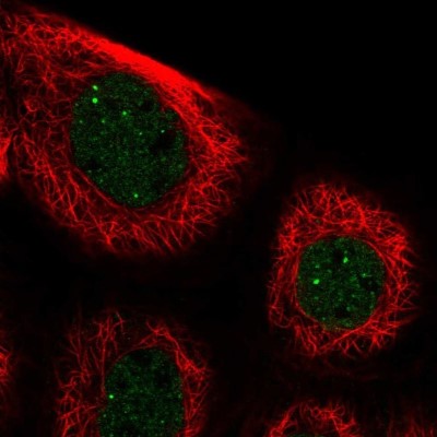 Immunocytochemistry/Immunofluorescence: Paralemmin 3 Antibody [NBP2-30529] - Staining of human cell line A-431 shows localization to nucleoplasm & nuclear bodies.