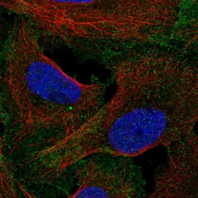 Immunocytochemistry/Immunofluorescence: LRRC69 Antibody [NBP2-14566] - Immunofluorescent staining of human cell line U-2 OS shows localization to plasma membrane.