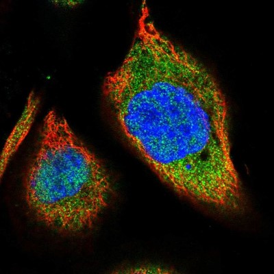 Immunocytochemistry/Immunofluorescence: FAM113A Antibody [NBP2-13976] - Immunofluorescent staining of human cell line A-431 shows localization to nucleoplasm & cytosol.