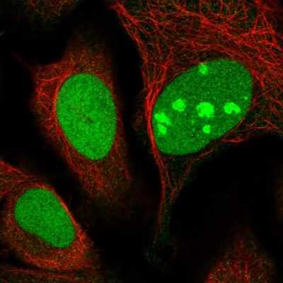 Immunocytochemistry/Immunofluorescence: ABCG4 Antibody [NBP2-14252] - Staining of human cell line U-2 OS shows positivity in nucleus and nucleoli.