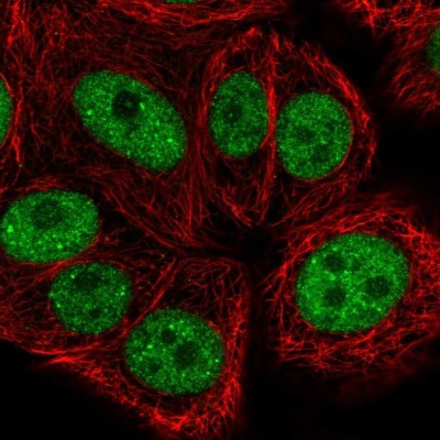 Immunocytochemistry/Immunofluorescence: BRF1 Antibody [NBP2-55335] - Staining of human cell line MCF7 shows localization to nucleoplasm & nuclear bodies.