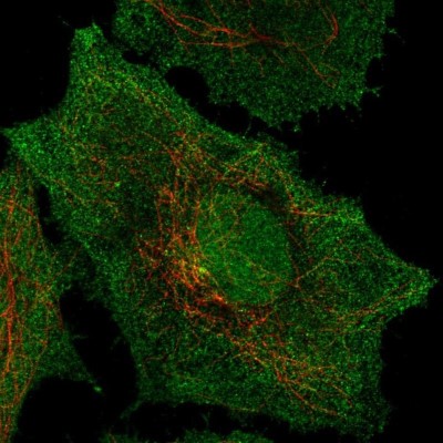Immunocytochemistry/Immunofluorescence: Signal peptide peptidase-like 2B Antibody [NBP2-55073] - Staining of human cell line SiHa shows localization to nucleoplasm, plasma membrane & centrosome.