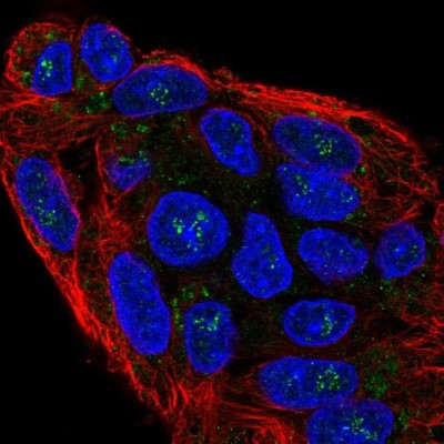 Immunocytochemistry/Immunofluorescence: NKD1 Antibody [NBP2-30532] - Staining of human cell line Hep G2 shows localization to nucleoli fibrillar center & cytosol.