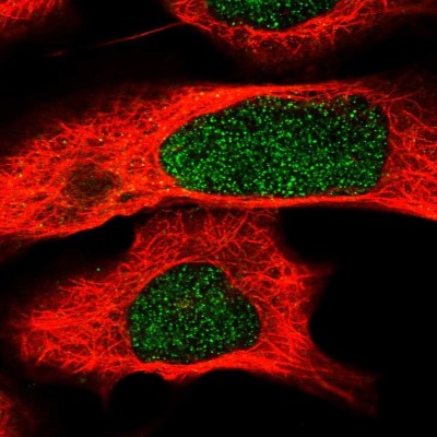 Immunocytochemistry/Immunofluorescence: RALGDS Antibody [NBP2-30584] - Immunofluorescent staining of human cell line U-2 OS shows localization to nucleus.