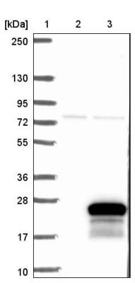 Western Blot: C19orf24 Antibody [NBP2-14800] - Lane 1: Marker [kDa] 250, 130, 95, 72, 55, 36, 28, 17, 10. Lane 2: Negative control (vector only transfected HEK293T lysate). Lane 3: Over-expression lysate (Co-expressed with a C-terminal myc-DDK tag (3.1 kDa) in mammalian HEK293T cells).