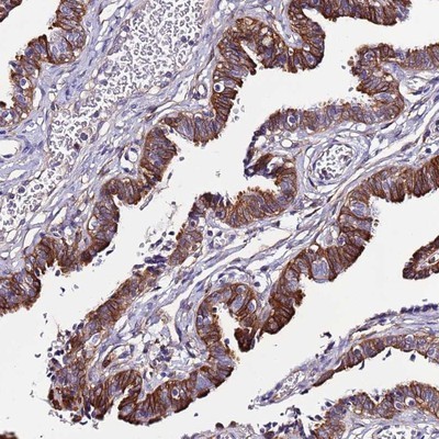 Immunohistochemistry-Paraffin: C19orf24 Antibody [NBP2-14800] - Staining of human fallopian tube shows strong cytoplasmic and membranous positivity in glandular cells.