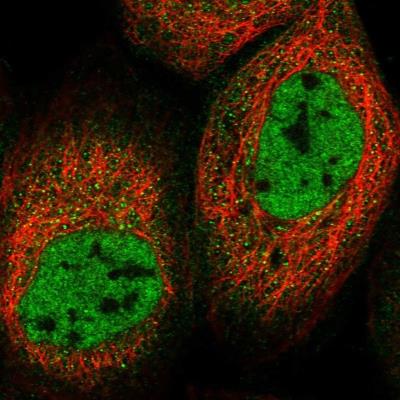 Immunocytochemistry/Immunofluorescence: CCDC140 Antibody [NBP2-14795] - Staining of human cell line A-431 shows positivity in nucleus but not nucleoli and cytoplasm.