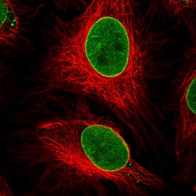 Immunocytochemistry/Immunofluorescence: ZNF224 Antibody [NBP2-30794] - Immunofluorescent staining of human cell line HeLa shows localization to nucleoplasm & nuclear membrane.