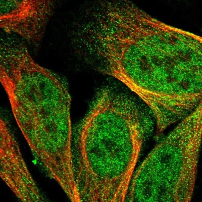 Immunocytochemistry/Immunofluorescence: DSCAM Antibody [NBP2-30716] - Immunofluorescent staining of human cell line U-2 OS shows localization to nucleoplasm & cytosol.