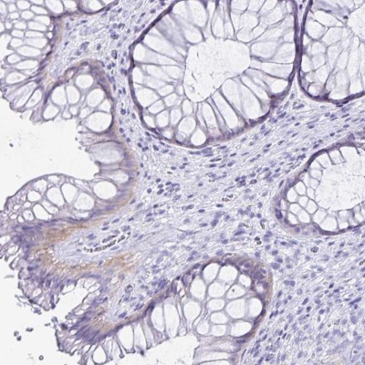 Immunohistochemistry-Paraffin: C19orf73 Antibody [NBP2-32367] - Staining of human rectum shows weak cytoplasmic positivity in glandular cells.