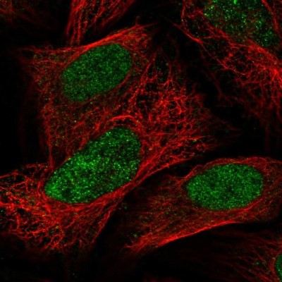 Immunocytochemistry/Immunofluorescence: PAPOLG Antibody [NBP2-55534] - Staining of human cell line U-2 OS shows localization to nucleus.