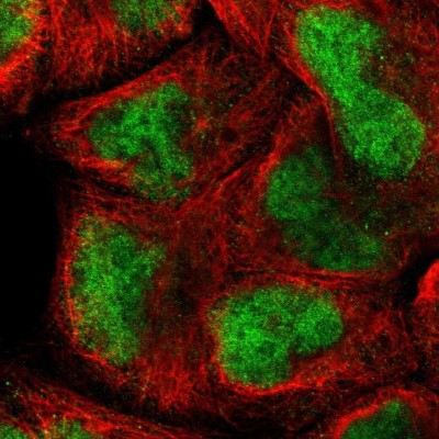 Immunocytochemistry/Immunofluorescence: AF10 Antibody [NBP1-90222] - Staining of human cell line A-431 shows localization to nucleoplasm.