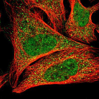 Immunocytochemistry/Immunofluorescence: Actin Regulatory Protein Antibody [NBP1-90213] - Staining of human cell line U-2 OS shows positivity in nucleus but not nucleoli and cytoplasm.