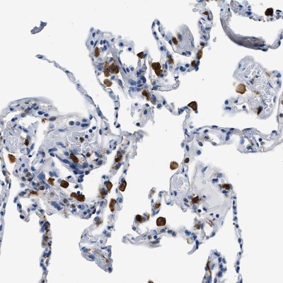 Immunohistochemistry-Paraffin: Actin Regulatory Protein Antibody [NBP1-90213] - Staining of human lung shows strong cytoplasmic and nuclear positivity in macrophages.