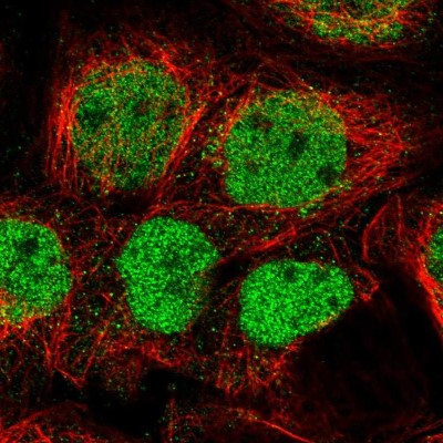Immunocytochemistry/Immunofluorescence: GPATCH2L Antibody [NBP1-94046] - Immunofluorescent staining of human cell line A-431 shows localization to nucleoplasm.