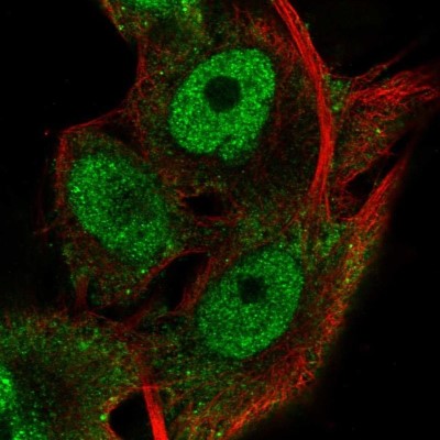 Immunocytochemistry/Immunofluorescence: RNF13 Antibody [NBP2-57493] - Staining of human cell line SK-MEL-30 shows localization to nucleoplasm & cytosol.