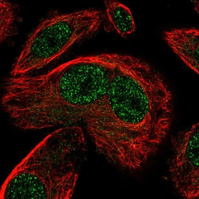 Immunocytochemistry/Immunofluorescence: SNAPC3 Antibody [NBP2-57713] - Staining of human cell line PC-3 shows localization to nucleoplasm.