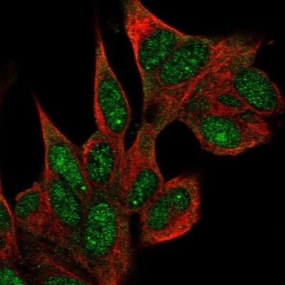 Immunocytochemistry/Immunofluorescence: Coilin Antibody [NBP2-57887] - Staining of human cell line SH-SY5Y shows localization to nucleus & nuclear bodies.
