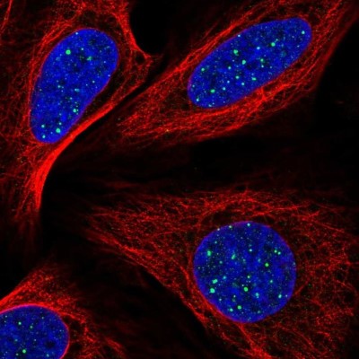 Immunocytochemistry/Immunofluorescence: TIN2 Antibody [NBP2-55709] - Staining of human cell line U-2 OS shows localization to nuclear bodies.