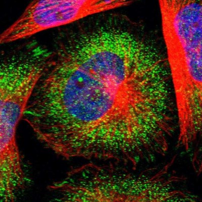 Immunocytochemistry/Immunofluorescence: USP40 Antibody [NBP1-90426] - Immunofluorescent staining of human cell line U-251 MG shows localization to focal adhesion sites & vesicles.