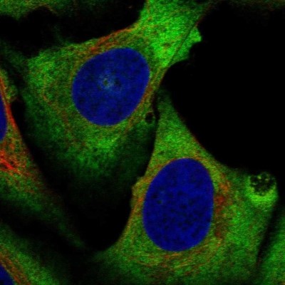 Immunocytochemistry/Immunofluorescence: eIF4A2 Antibody [NBP2-57716] - Staining of human cell line U-2 OS shows localization to cytosol.