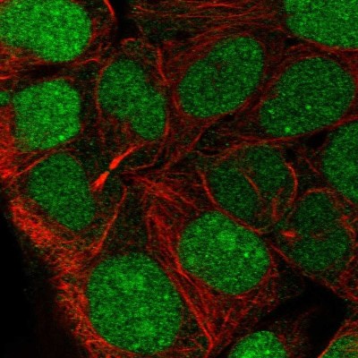 Immunocytochemistry/Immunofluorescence: CCDC84 Antibody [NBP2-57702] - Staining of human cell line CACO-2 shows localization to nucleus.
