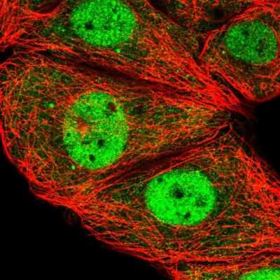 Immunocytochemistry/Immunofluorescence: ESRP2 Antibody [NBP2-58259] - Staining of human cell line MCF7 shows localization to nucleoplasm.
