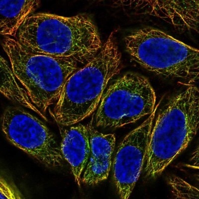 Immunocytochemistry/Immunofluorescence: DNAH2 Antibody [NBP2-49506] - Staining of human cell line SiHa shows localization to microtubules.