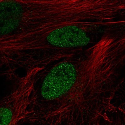 Immunocytochemistry/Immunofluorescence: DPF3 Antibody [NBP2-49494] - Staining of human cell line BJ shows localization to nucleoplasm.