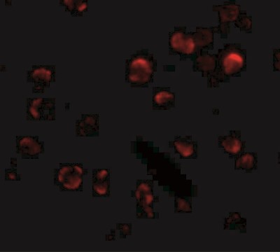 Immunocytochemistry/Immunofluorescence: KLHL15 Antibody [NBP1-77359] - Immunofluorescence of KLHL15 in HeLa cells with KLHL15 antibody at 20 ug/mL.