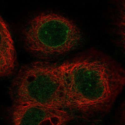 Immunocytochemistry/Immunofluorescence: C4orf29 Antibody [NBP2-30812] - Immunofluorescent staining of human cell line A-431 shows localization to nuclear membrane.