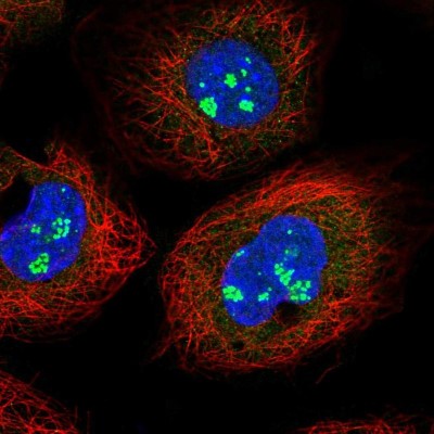 Immunocytochemistry/Immunofluorescence: KIAA1430 Antibody [NBP2-30874] - Immunofluorescent staining of human cell line A-431 shows localization to nucleoli fibrillar center.