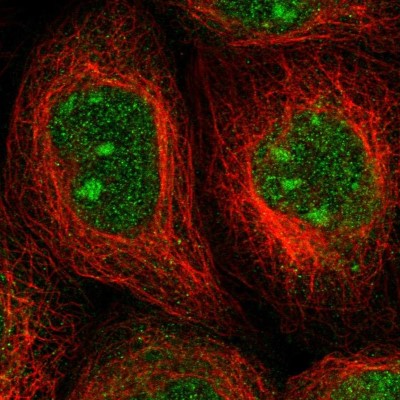 Immunocytochemistry/Immunofluorescence: ALG14 Antibody [NBP2-30914] - Immunofluorescent staining of human cell line A-431 shows localization to nucleus & nucleoli.
