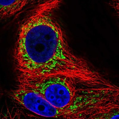 Immunocytochemistry/Immunofluorescence: SFXN1 Antibody [NBP2-57172] - Staining of human cell line MCF7 shows localization to mitochondria.